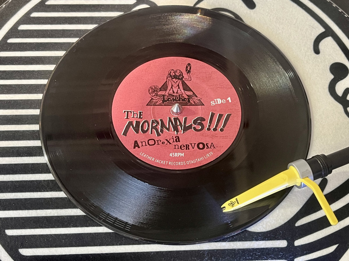 
                  
                    The Normals - Anorexia Nervosa (RSD26)
                  
                