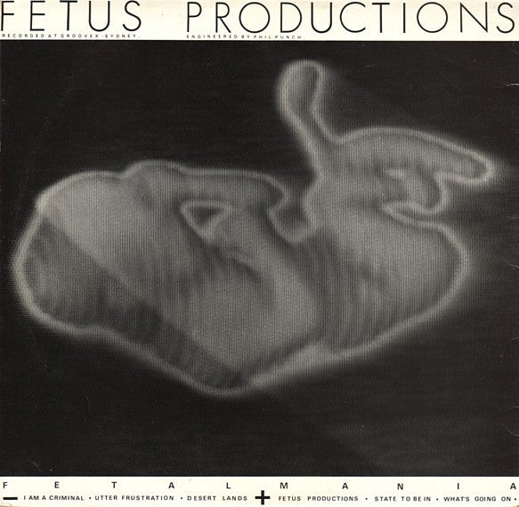 
                  
                    F.PRO999 Fetus Productions - Fetalmania (1983)
                  
                