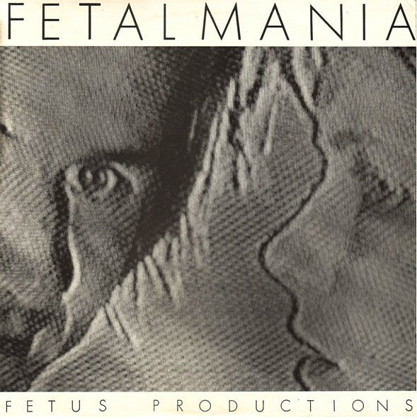 
                  
                    F.PRO999 Fetus Productions - Fetalmania (1983)
                  
                