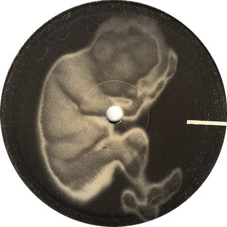 
                  
                    F.PRO999 Fetus Productions - Fetalmania (1983) - Flying Nun  | Vinyl | CD
                  
                