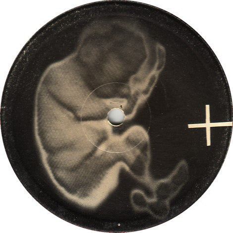 
                  
                    F.PRO999 Fetus Productions - Fetalmania (1983) - Flying Nun  | Vinyl | CD
                  
                